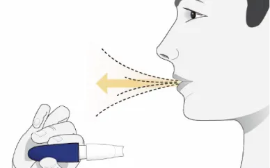 Illustration som visar händer som drar isär Inbrija-inhalatorns komponenter, markerade med en gul pil.
