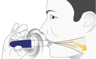 Illustration som visar händer som öppnar en blisterförpackning för att ta ut en Inbrija-kapsel.